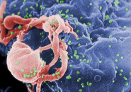 THÊM NGƯỜI KHỎI HIV NHỜ PHƯƠNG PHÁP GHẾ TẾ BÀO GỐC