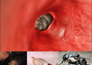 Các loại ký sinh trùng sống trên cơ thể người