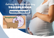 Ký Sinh Trùng Mèo Toxoplasma: Phân Biệt IgM Và IgG