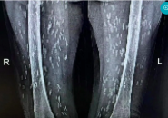 Nghiện Món Vạn Người Mê, Cụ Bà Bị Kén Sán Ken Đặc Khắp Cơ Thể