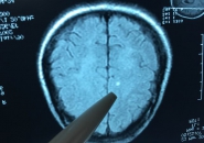 Sán chó cướp đi sinh mạng tràng trai 19 tuổi