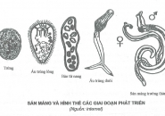 BỆNH SÁN MÁNG LÀ GÌ? CÁC TRIỆU CHỨNG CỦA BỆNH SÁN MÁNG