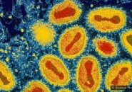 NHỮNG HIỂU BIẾT VỀ VI KHUẨN, VI RÚT  VÀ KÝ SINH TRÙNG GIÚP BẢO VỆ CƠ THỂ