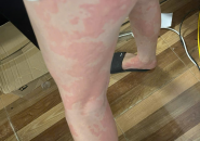 Tổng quan về bệnh ký sinh trùng mèo Toxoplasma gondii: Những điều cần biết