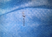 Trị Bệnh Sán Chó Có Khỏi Bệnh Ngứa Da Không?