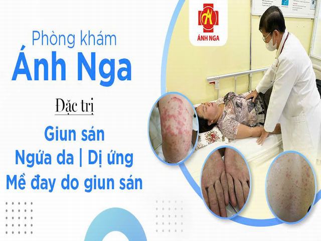 TRIỆU CHỨNG GIUN SÁN CHÓ MÈO