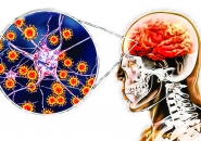 BÙNG PHÁT VIÊM NÃO DO NẤM TẠI MỸ VÀ MEXICO