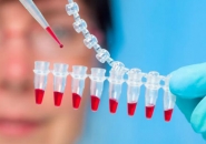 Ý NGHĨA VÀ QUY TRÌNH XÉT NGHIỆM ĐÔNG MÁU 